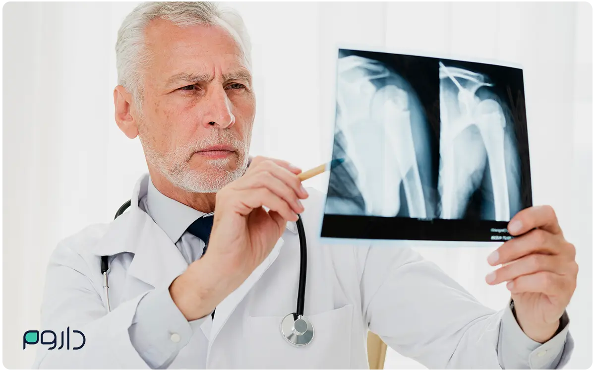 x-ray پوکی استخوان و استفاده از آمپول دنوزوماب