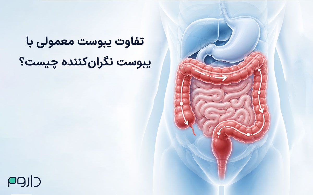تصویر مفهومی دستگاه گوارش و روده بزرگ با نمایش مسیر حرکت مواد در یبوست